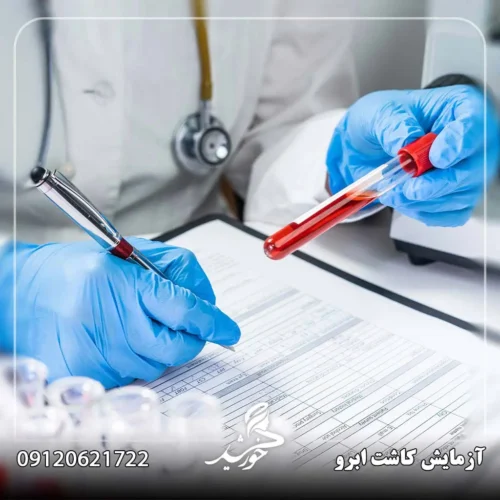 آزمایش قبل از کاشت ابرو