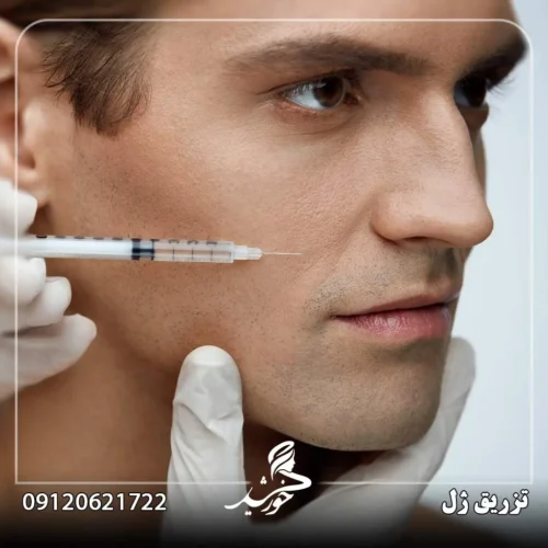 تزریق ژل برای رفع افتادگی