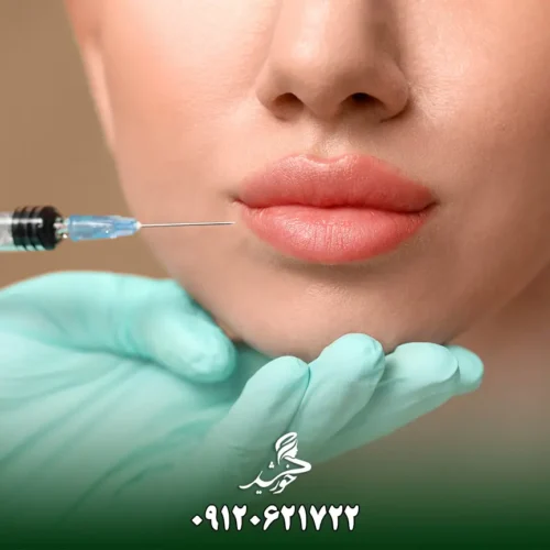 various-forms-of-gel-and-lip-filler