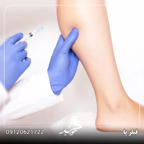 تزریق ژل و فیلر برای پا