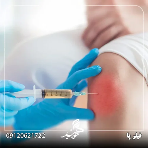 رعایت مراقبت‌های بعد از عمل