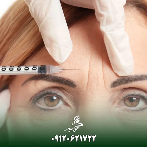 هر آنچه درباره مراقبتها و نکات تزریق بوتاکس باید بدانید