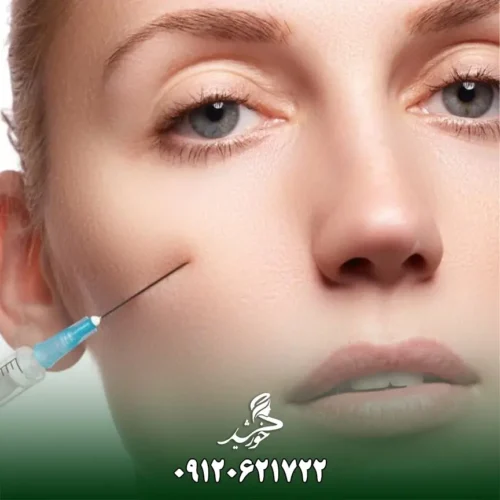 نکات مهم درباره کانولا در تزریق فیلر و ژل: یک بررسی جامع