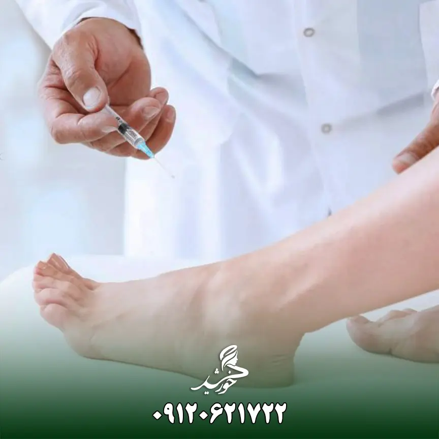راهنمای کامل تزریق ژل یا فیلر پا: هرآنچه که باید بدانید