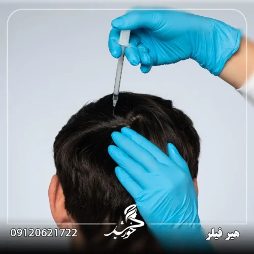 هیرفیلر برای چه کسانی مناسب نیست؟