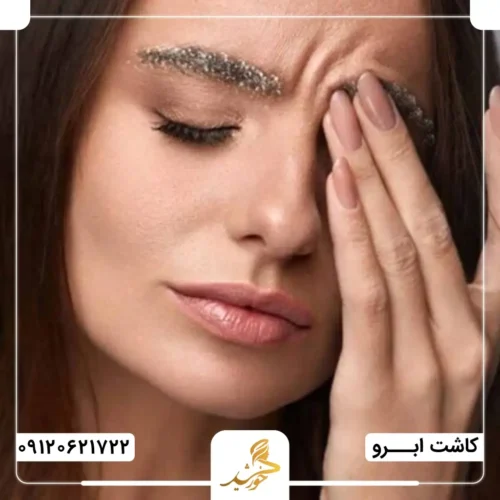 آسیب رسیدن به گرافت‌ها و جابه‌جایی آن‌ها؛ از عوارض شروع زودهنگام ورزش پس از کاشت ابرو