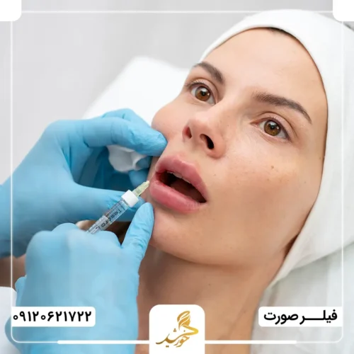 تخلیه فیلر با آنزیم