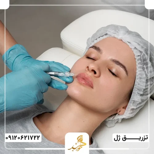 تزریق ژل چیست؟