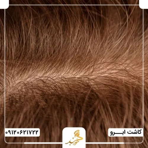 اهمیت تعیین بانک موی مناسب