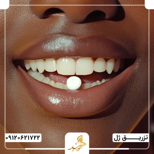 داروهای درمان تورم لب پس از تزریق ژل