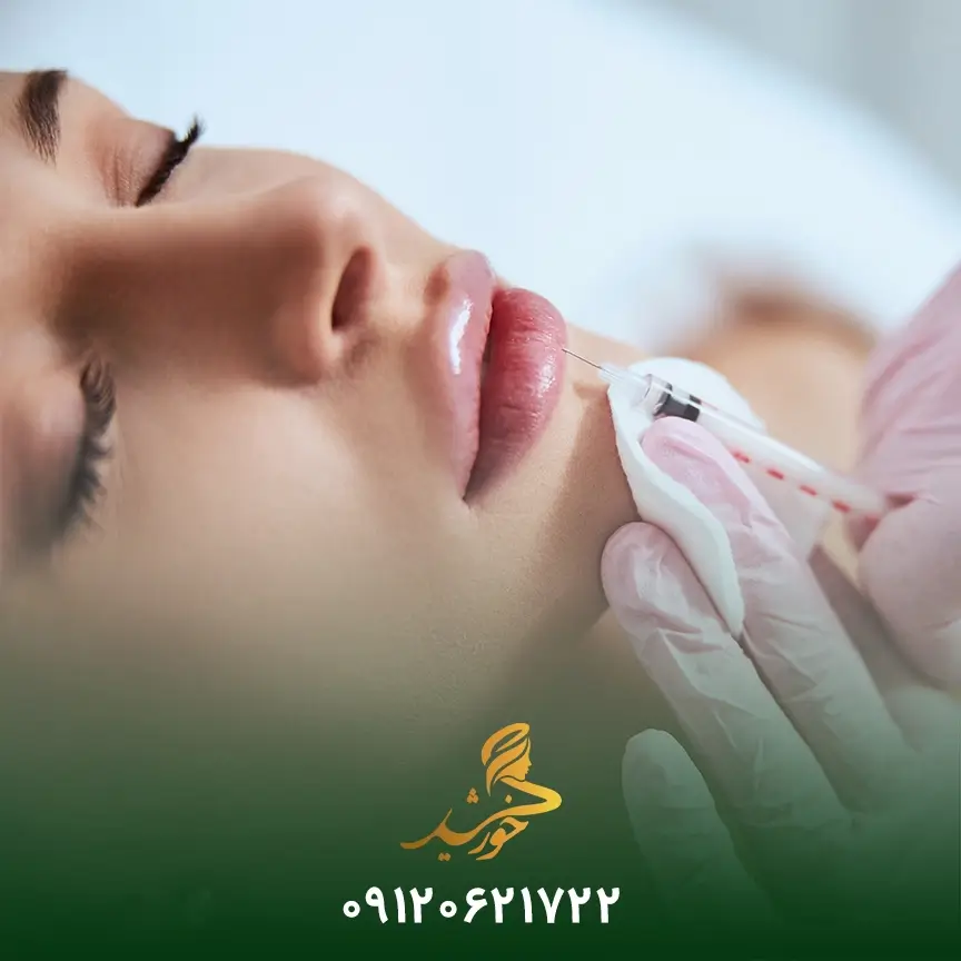 نکات مهم بعد از تزریق ژل