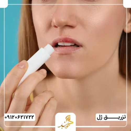 واکنش آلرژیک پس از تزریق ژل لب