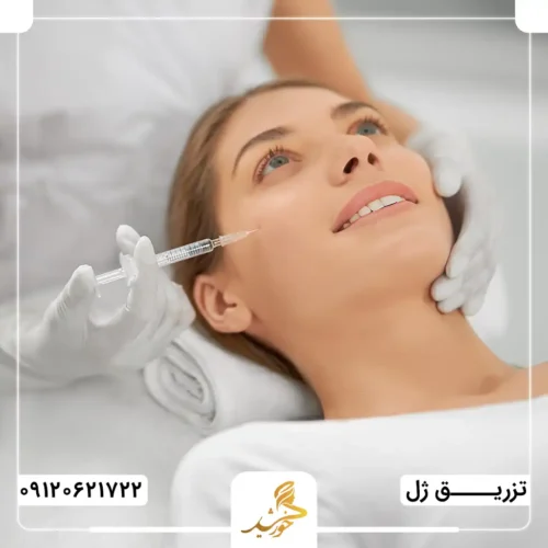 برای تزریق هیالورونیک اسید به گونه، چند سی‌سی ژل لازم است؟