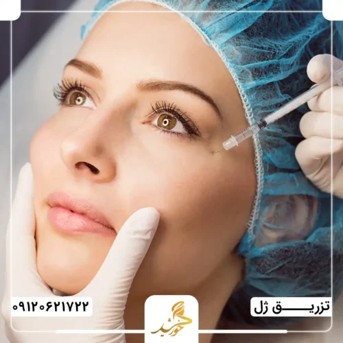 تزریق بهترین هیالورونیک اسید به گونه‌ها در کلینیک زیبایی خورشید