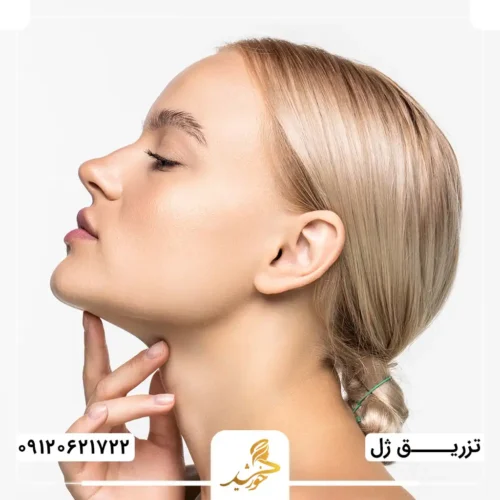 دوره نقاهت هایفو