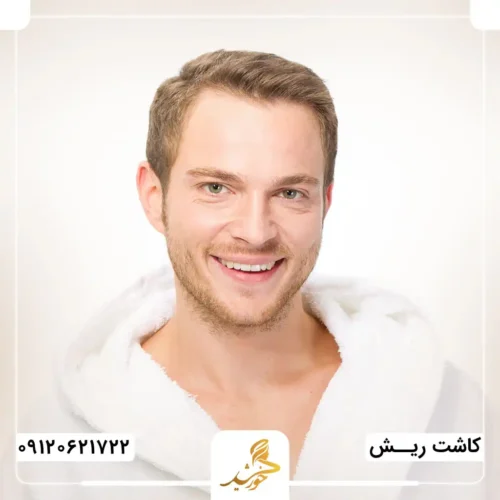 دوره نقاهت کوتاه پیوند ریش به روش میکروگرافت