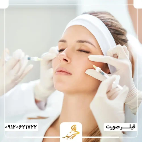 راهکارهایی برای افزایش میزان ماندگاری فیلر