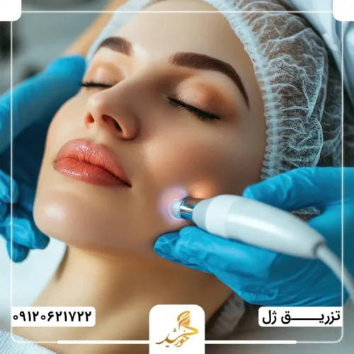 عوارض تزریق ژل بلافاصله پس از هایفو