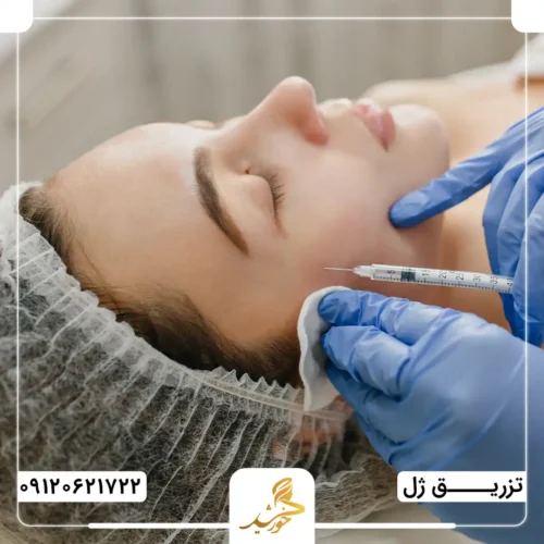 مراقبت‌های پس از تزریق ژل هیالورونیک اسید به گونه