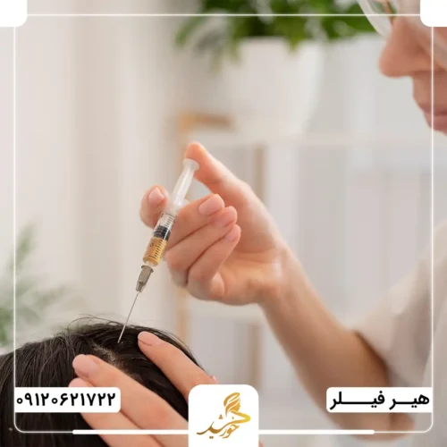 مزوتراپی مو چیست؟