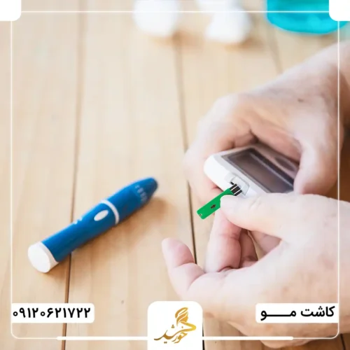 مشکل دیابتی‌ها در کاشت مو