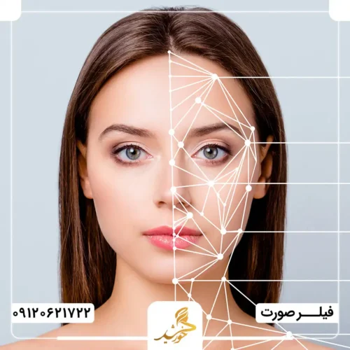 میزان ماندگاری فیلر پلی لاکتیک اسید