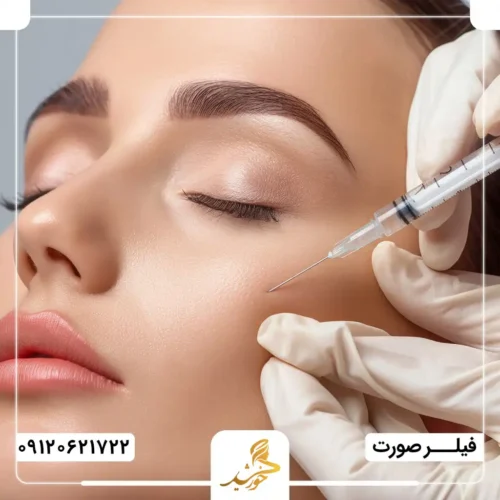 میزان ماندگاری فیلر گونه‌ها