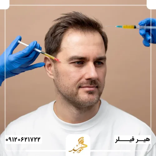 هیر فیلر انجام دهیم یا مزوتراپی؟