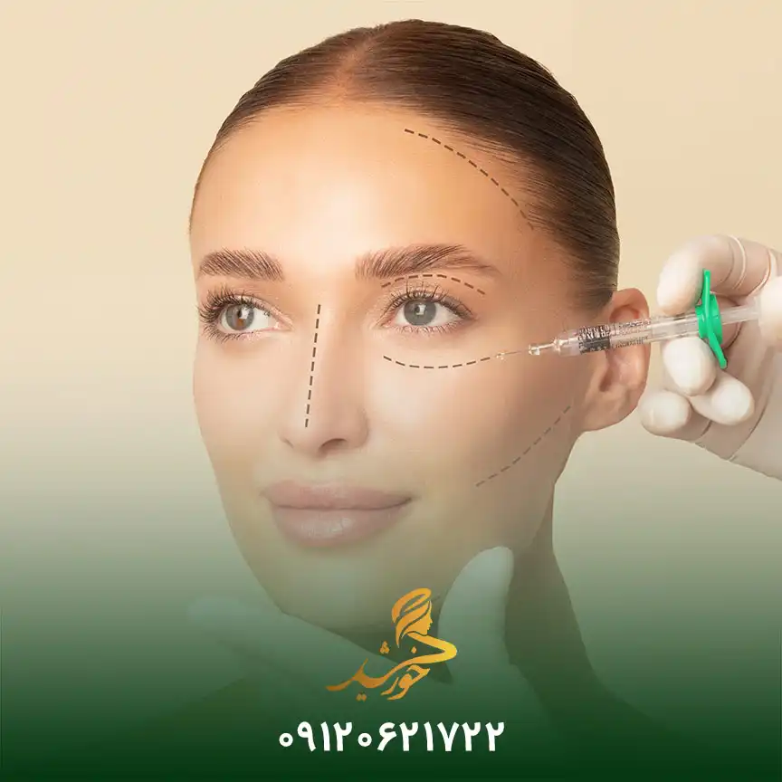 چاق و پرشدن صورت پس از تزریق فیلر