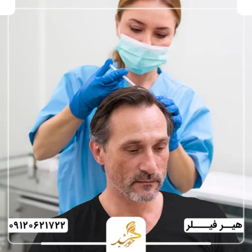 چه افرادی می‌توانند هیر فیلر انجام دهند؟