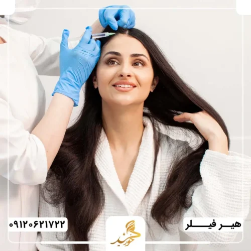 افزایش تراکم موها با تزریق فیلر مو