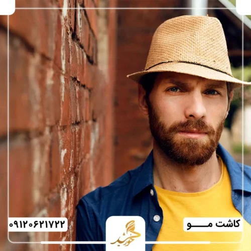 مشکلات استفاده از کلاه بلافاصله پس از کاشت مو