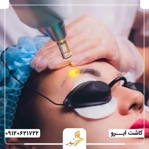 آیا برای کاشت ابرو باید تتو را پاک کرد؟