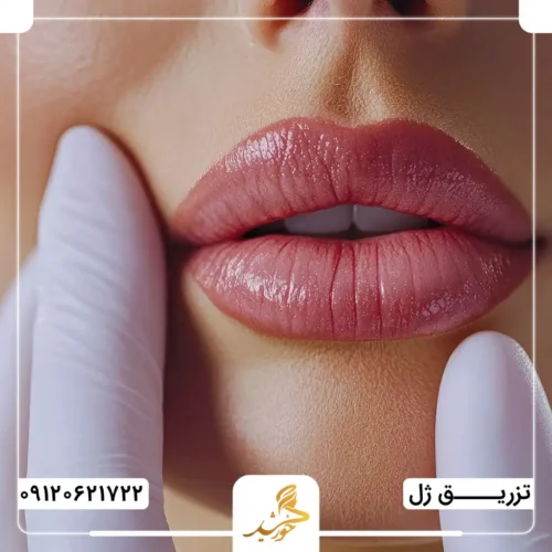 ژل لب موقت ضرر بیشتری دارد یا ژل دائمی؟