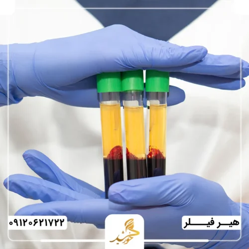 آشنایی با روش پی‌آر‌پی برای مو