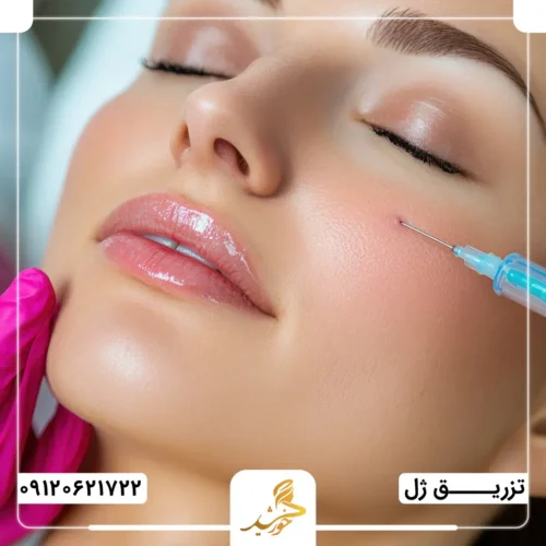 تزریق ژل به گونه در کلینیک زیبایی خورشید