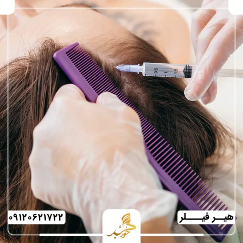 تفاوت هیرفیلر و پی‌آر‌پی از نظر ماندگاری