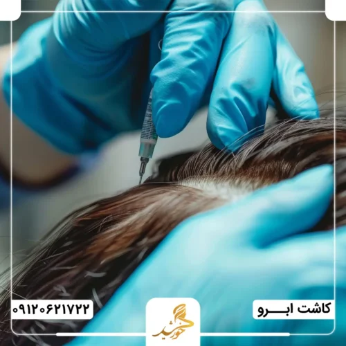 معایب و مشکلات کاشت ابرو به روش میکروگرافت