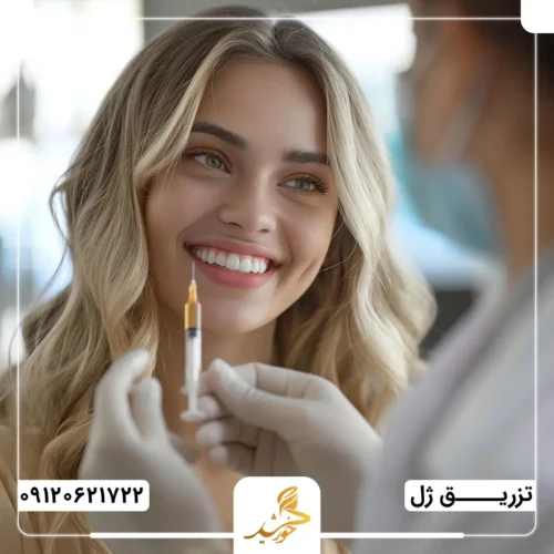 میزان ژل موردنیاز برای تزریق به گونه