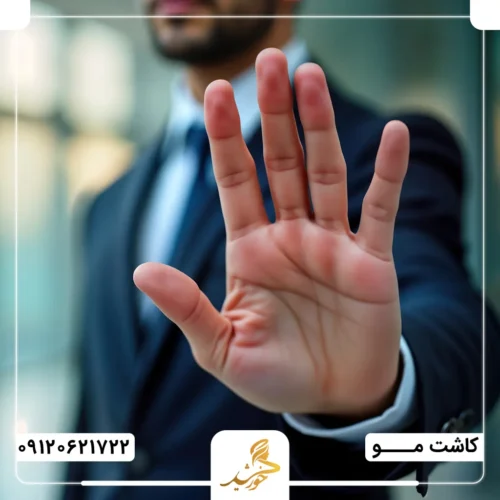 افرادی که از مزوتراپی بعد از پیوند مو منع می‌شوند!