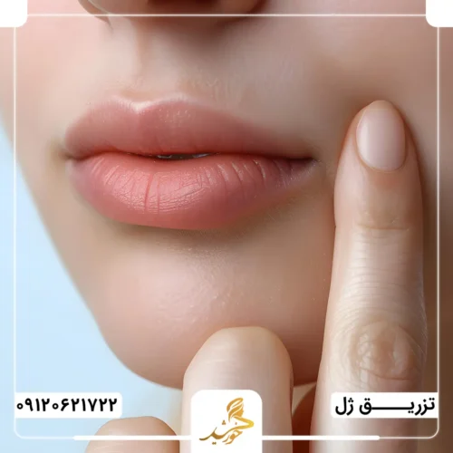 اهمیت توجه به مراقبت‌های پس از تزریق ژل خط خنده