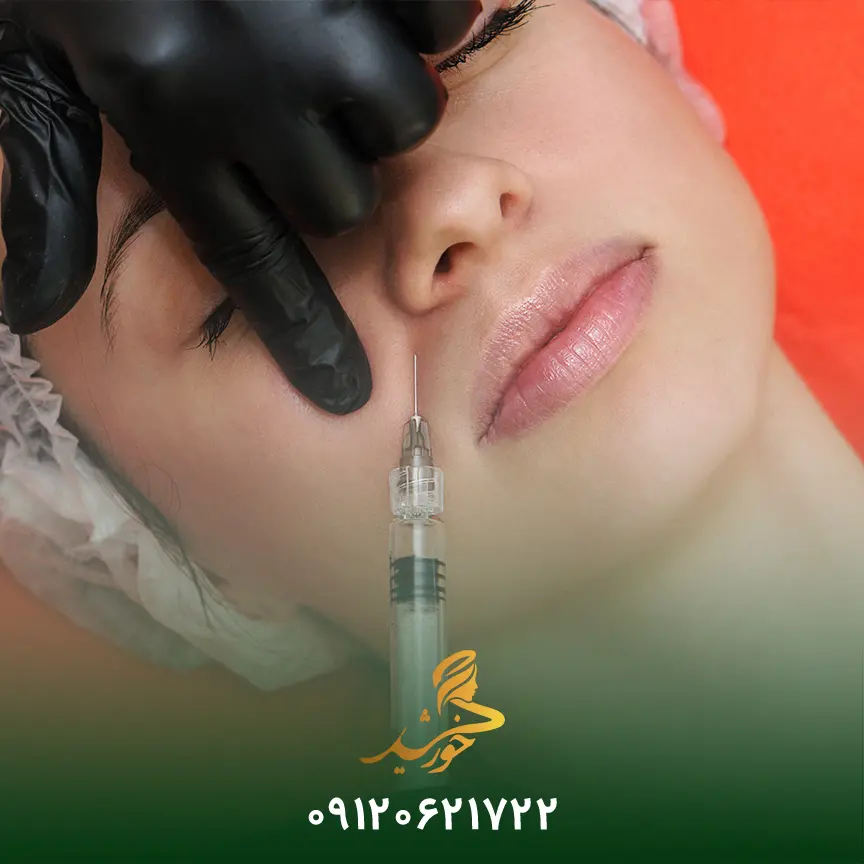 غذا خوردن پس از تزریق ژل خط خنده