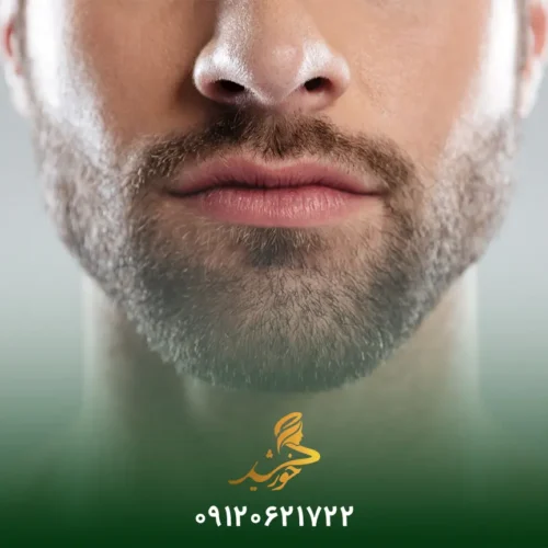 پیوند ریش پرتراکم