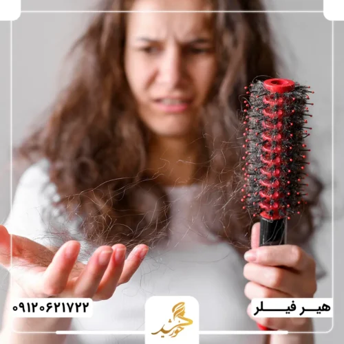 آشنایی با ریزش ارثی