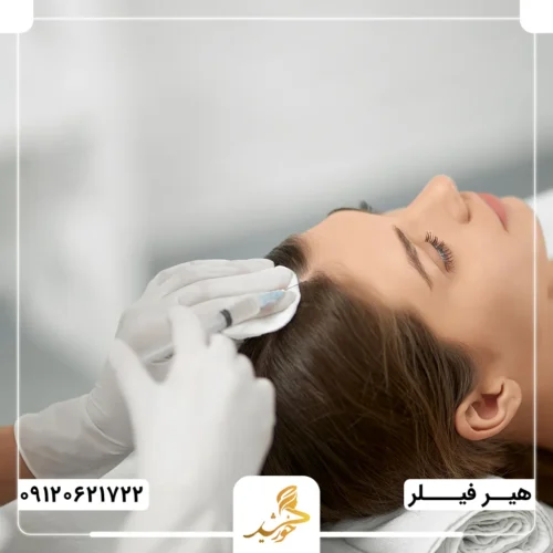 تزریق هیرفیلر برای کنترل ریزش ارثی مو در کلینیک خورشید