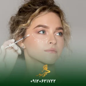 تزریق ژل برای گودی زیر چشم