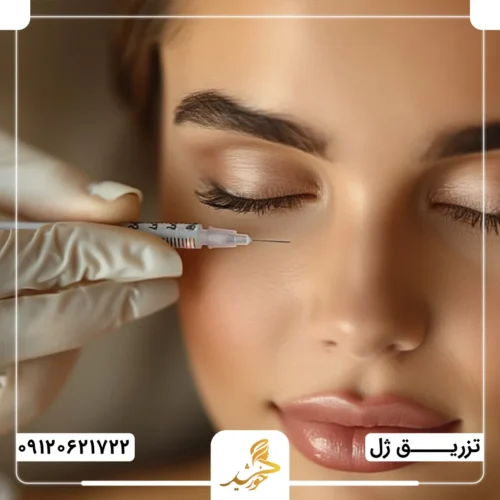 تزریق ژل برای گودی زیر چشم در کلینیک زیبایی خورشید