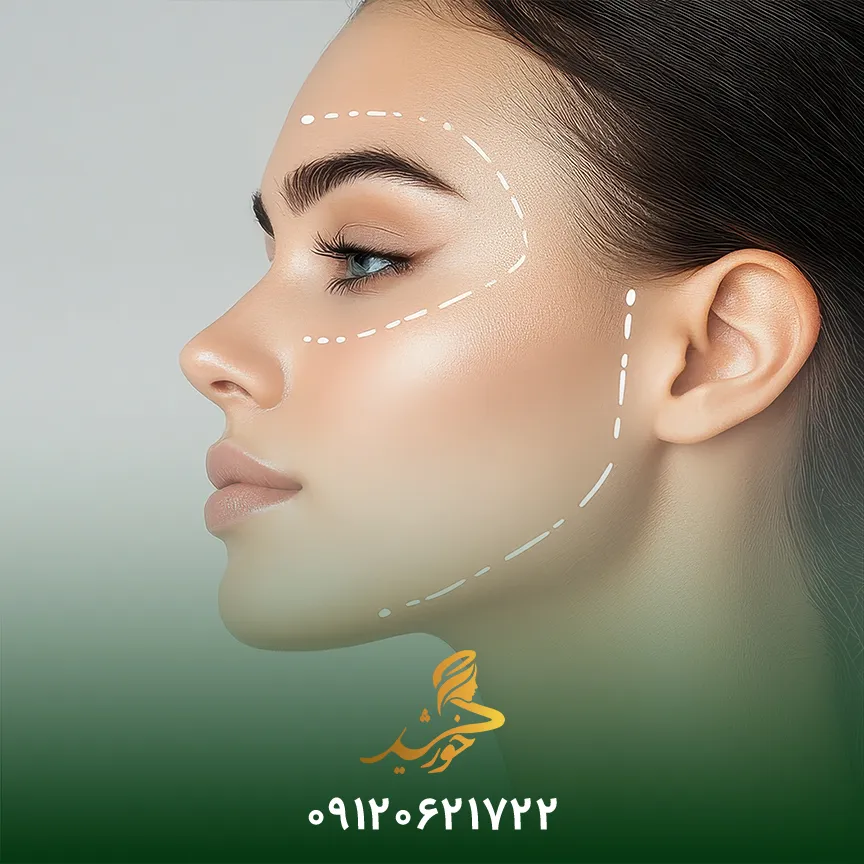 درد تزریق فیلر صورت