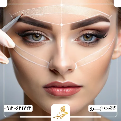 شرایط لازم برای پیوند FUT ابرو