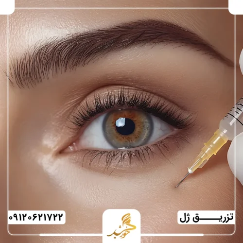مدت زمان ماندگاری ژل زیر چشم